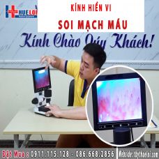 Kính Hiển Vi Soi Mạch Máu Phát Hiện Bất Thường