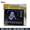 Máy siêu âm di động P10