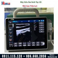 Máy siêu âm di động P10