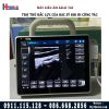 Máy siêu âm di động P10