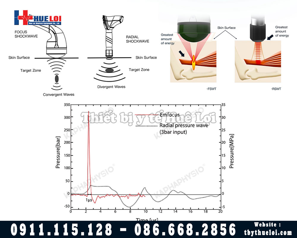 cơ chế hoạt động máy xung kích hội tụ