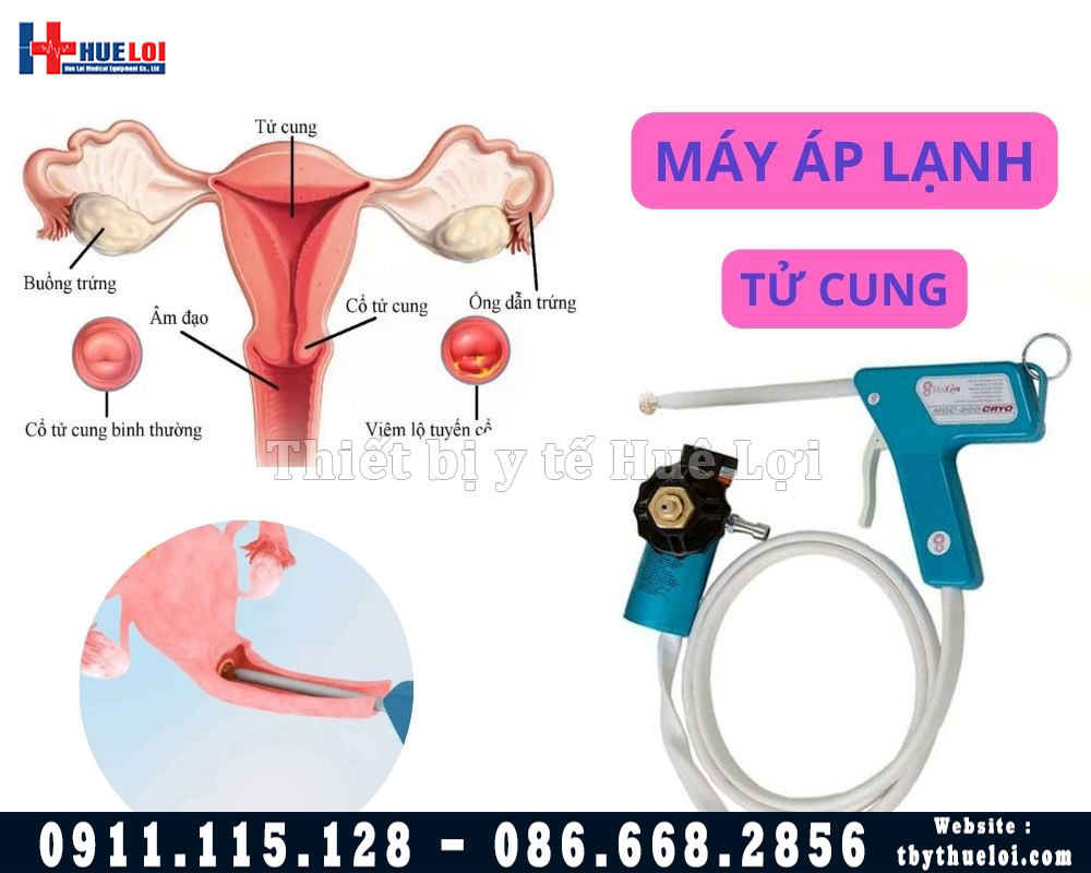 máy áp lạnh cổ tử cung của mỹ