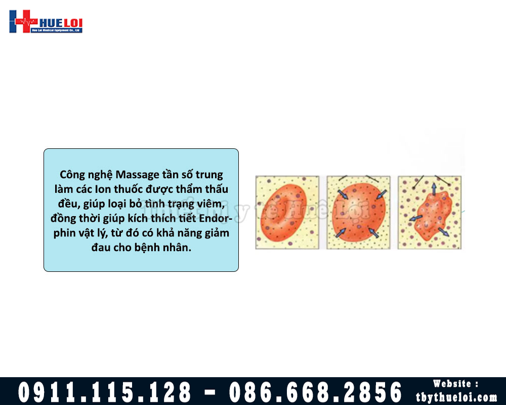 công nghệ massage máy điều trị bệnh lý tuyến tiền liệt