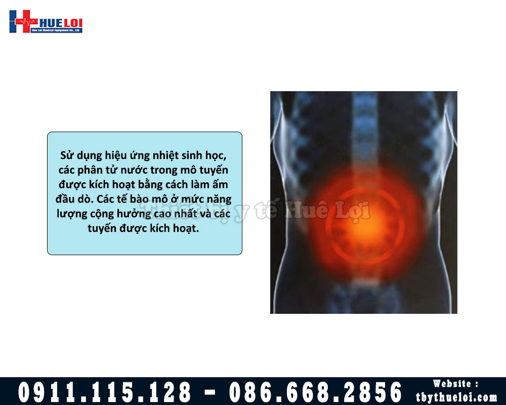 nguyên lý hoạt động của máy điều trị tuyến tiền liệt