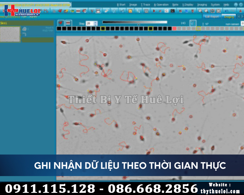 hình ảnh phân tích tinh trùng