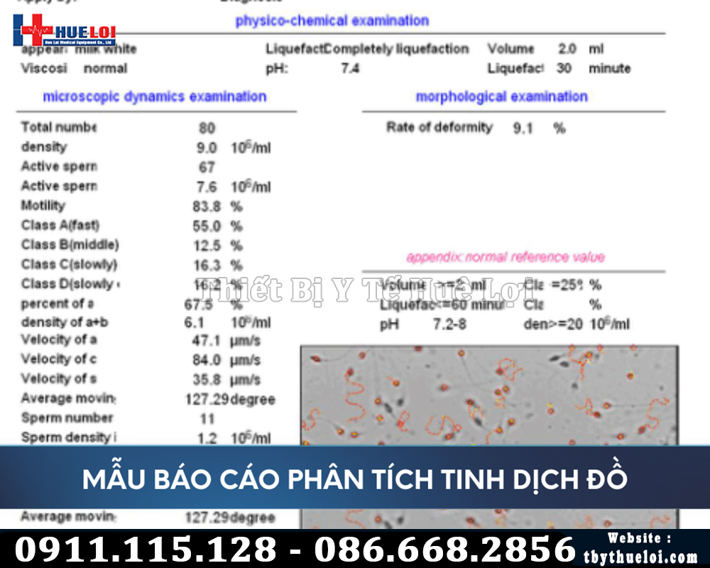 kết quả phân tích tinh trùng