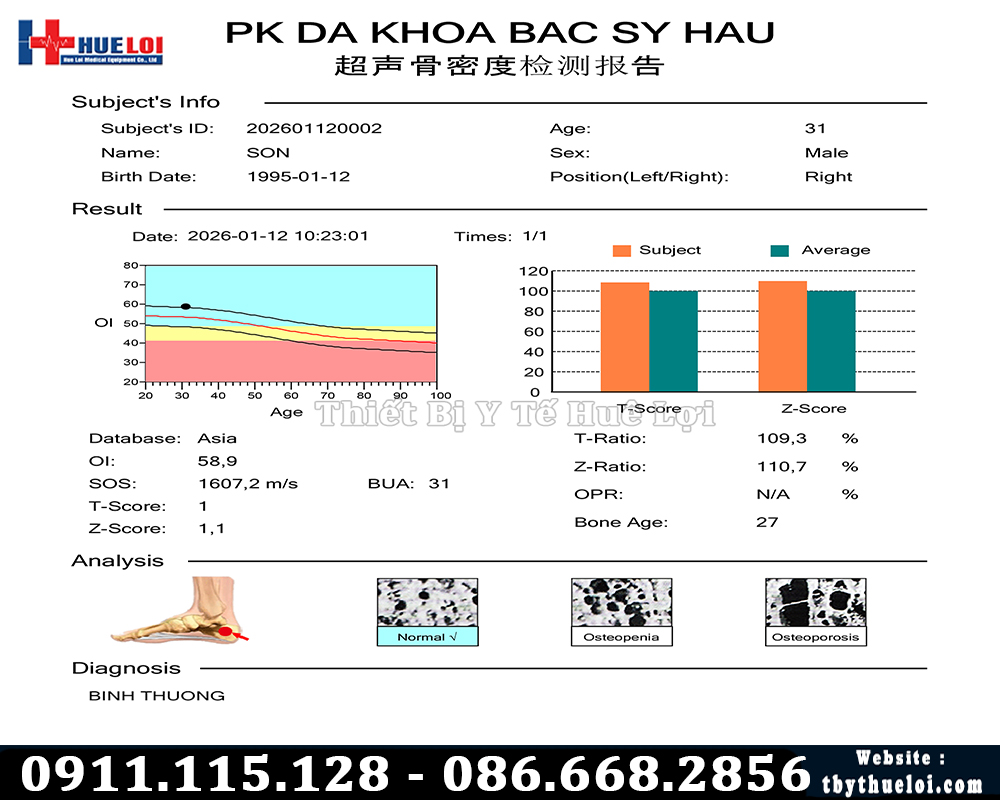 kết quả đo loãng xương