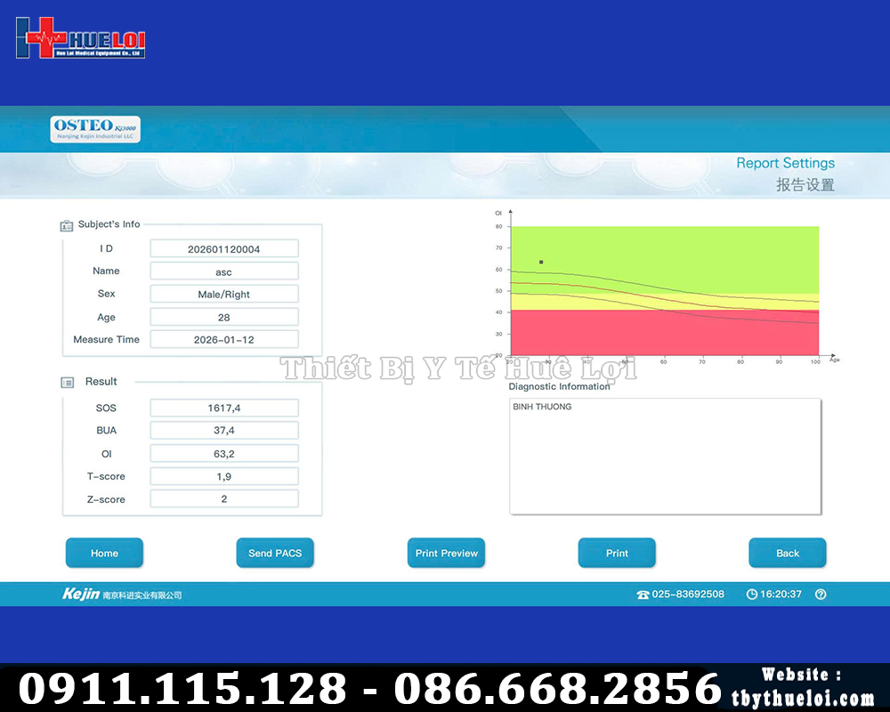 kết quả đo mật độ xương