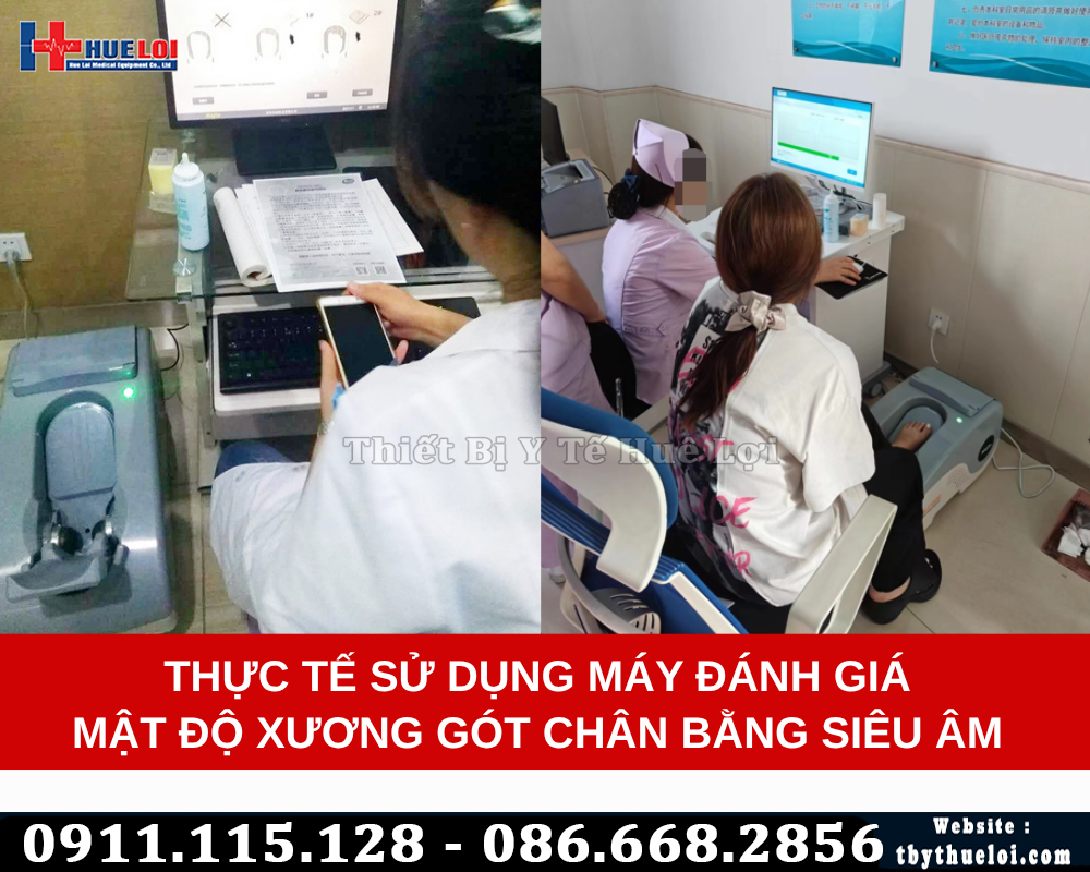 thiết bị đo loãng xương