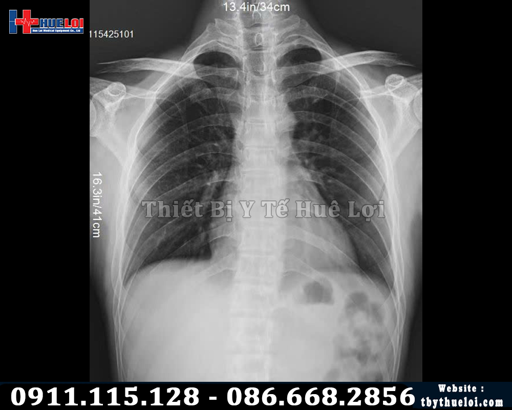 hinh ảnh chụp máy x quang