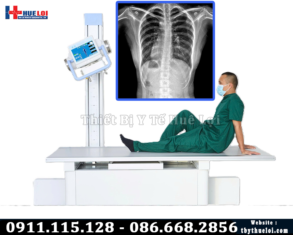 Máy Chụp X Quang YOLONG