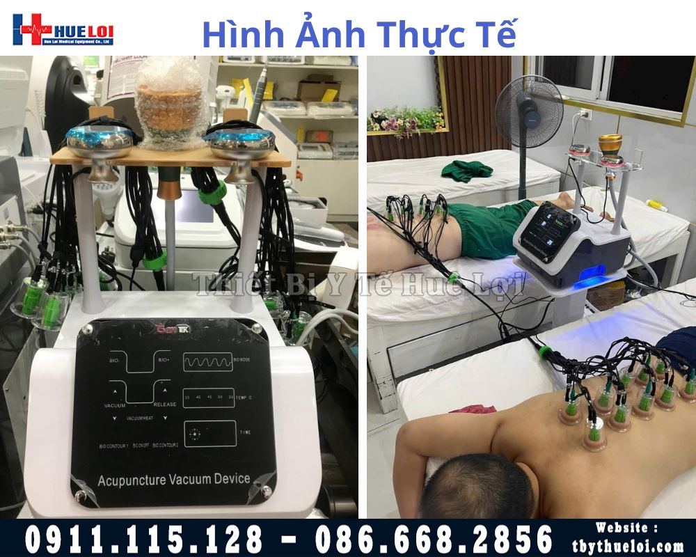 máy điện châm giác hơi