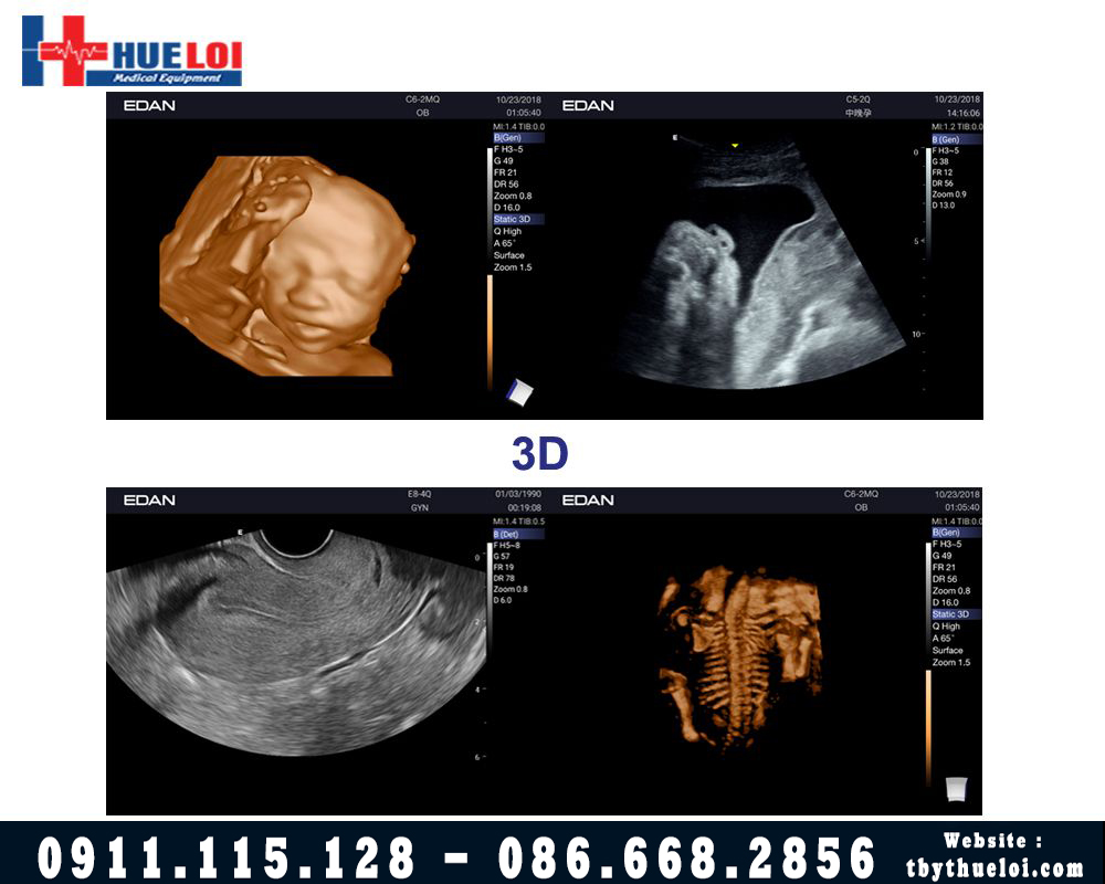 Hình ảnh 3D Ax3