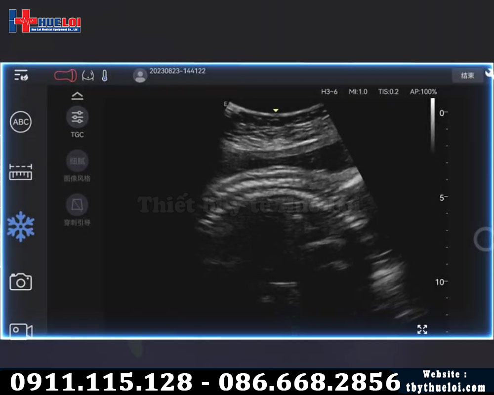 Edan nano C5 hình ảnh siêu âm