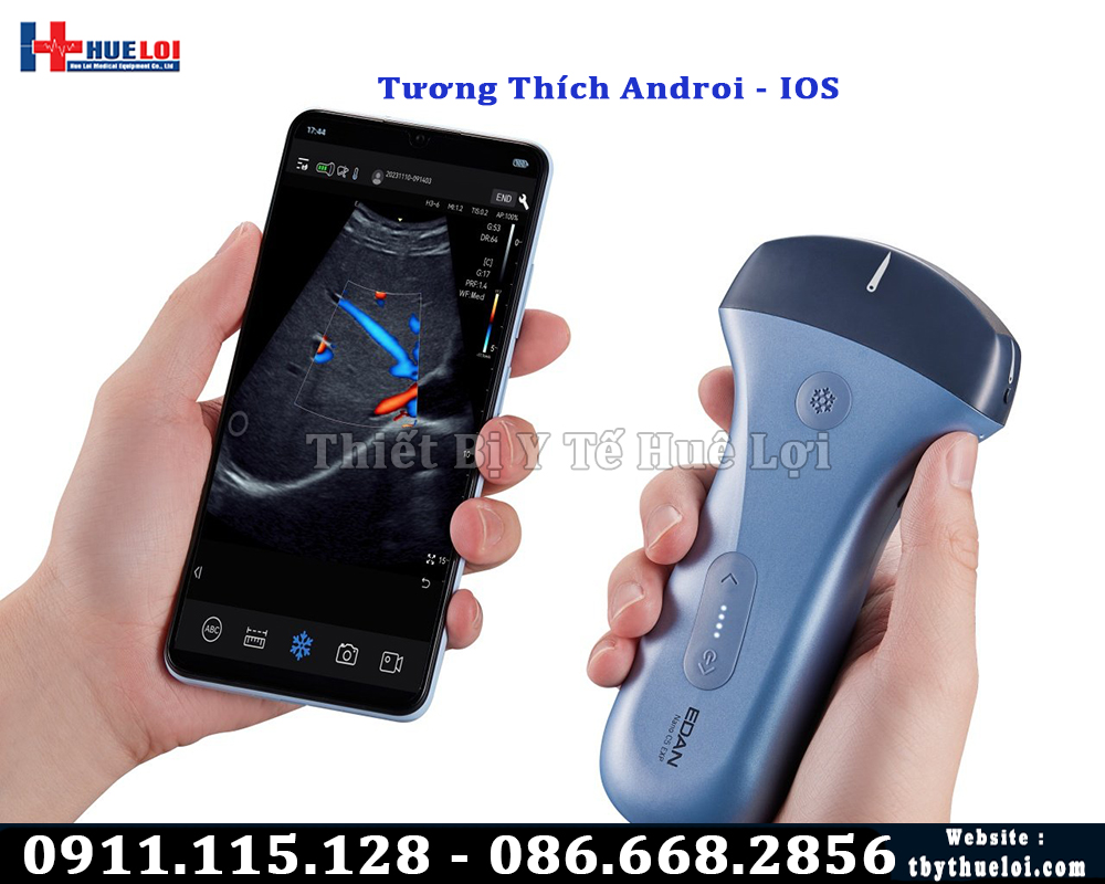 máy siêu âm cầm tay kết nối điện thoại