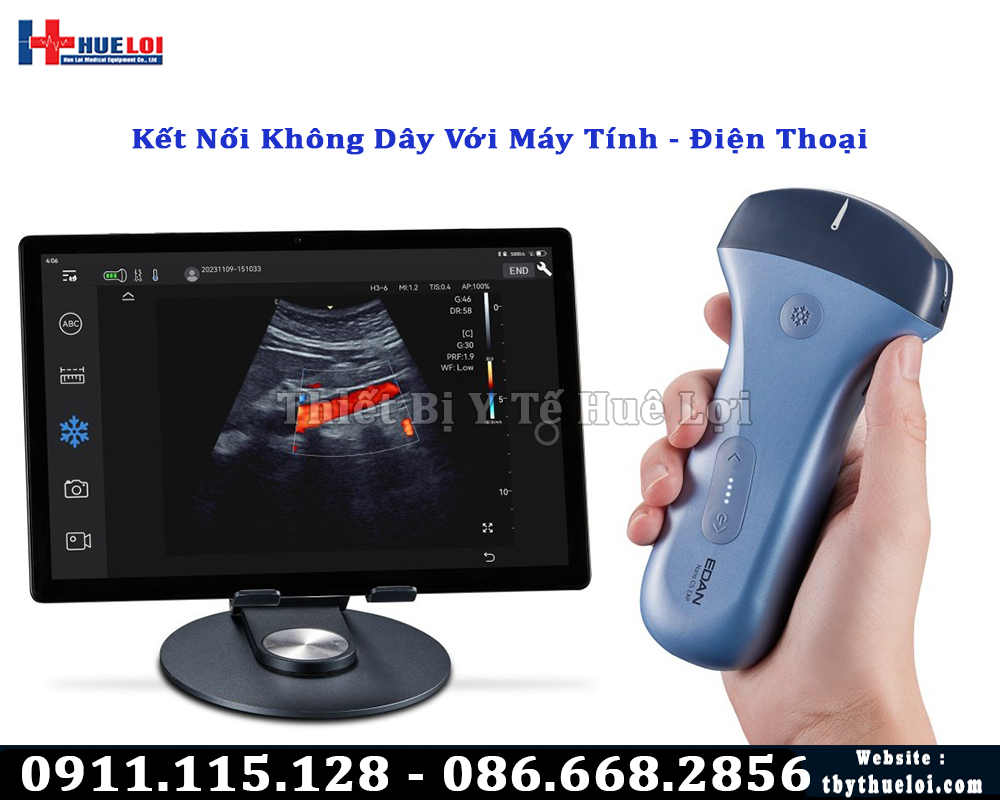 máy siêu âm cầm tay kết nối máy tính