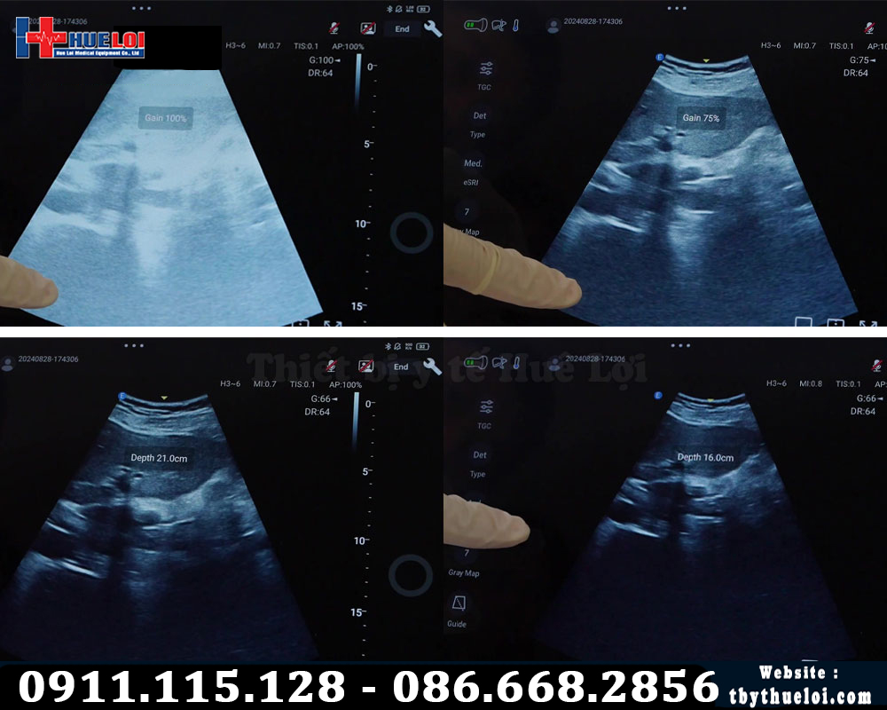 máy siêu âm edan c5 exp