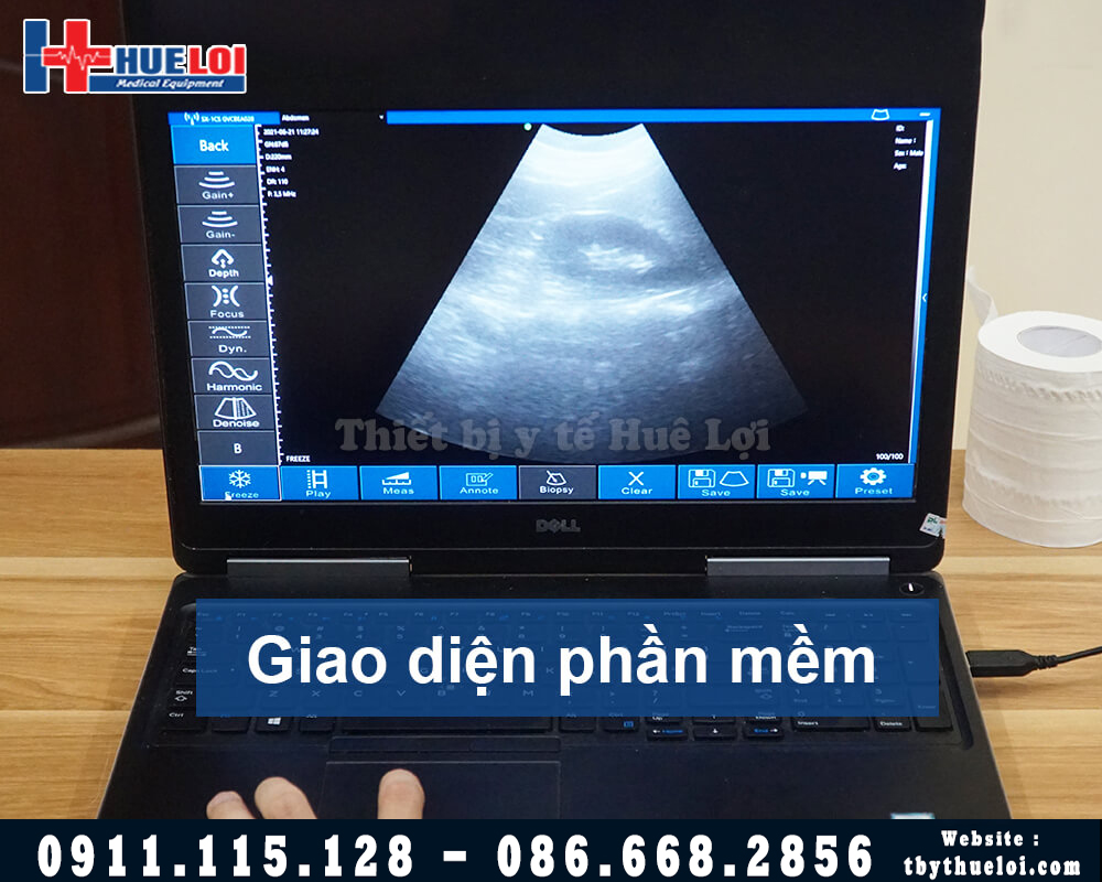 phần mềm máy siêu âm không dây