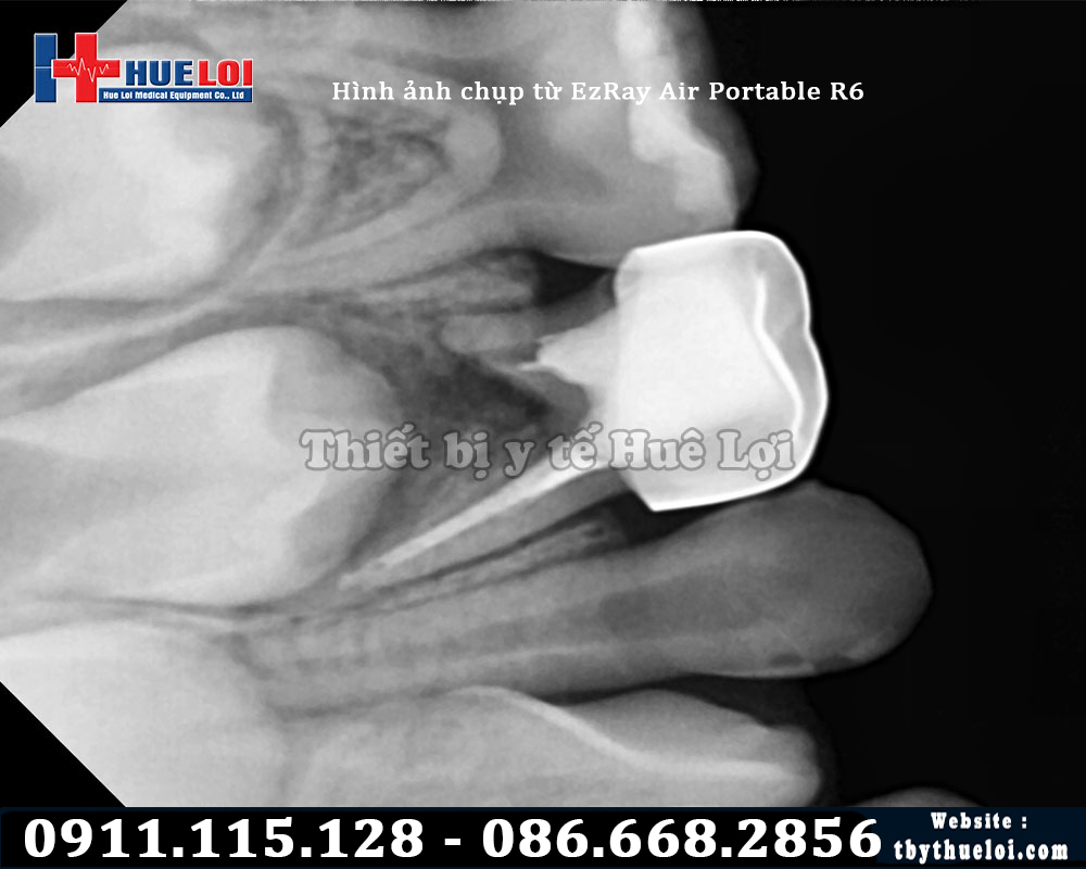 Chất lượng hình ảnh máy chụp X quang răng vatech hàn quốc