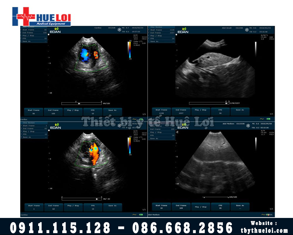 Hình ảnh siêu âm chó mèo bằng máy siêu âm thú y Edan VET