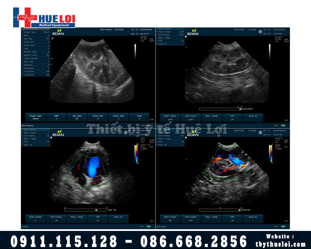 Siêu âm trên động vật máy siêu âm thú y EDAN VET U50