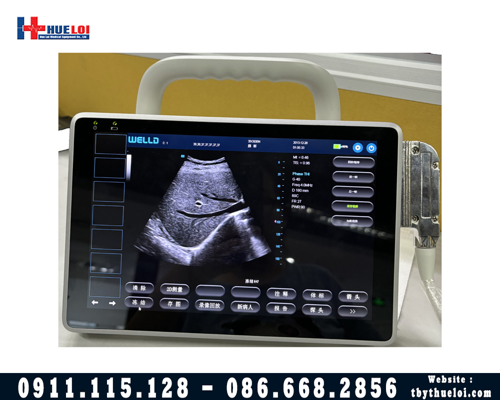máy siêu âm chuẩn đoán sách tay nhỏ gọn