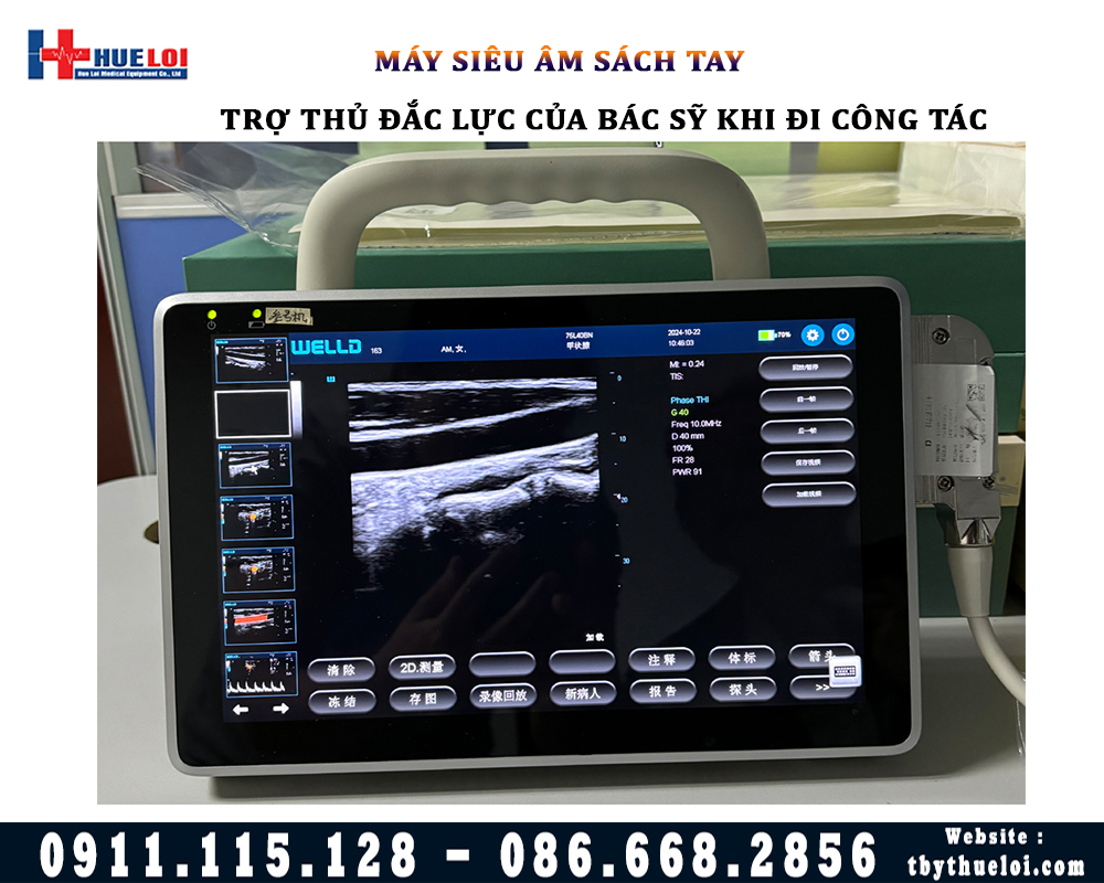 máy siêu âm sách tay p10 well D