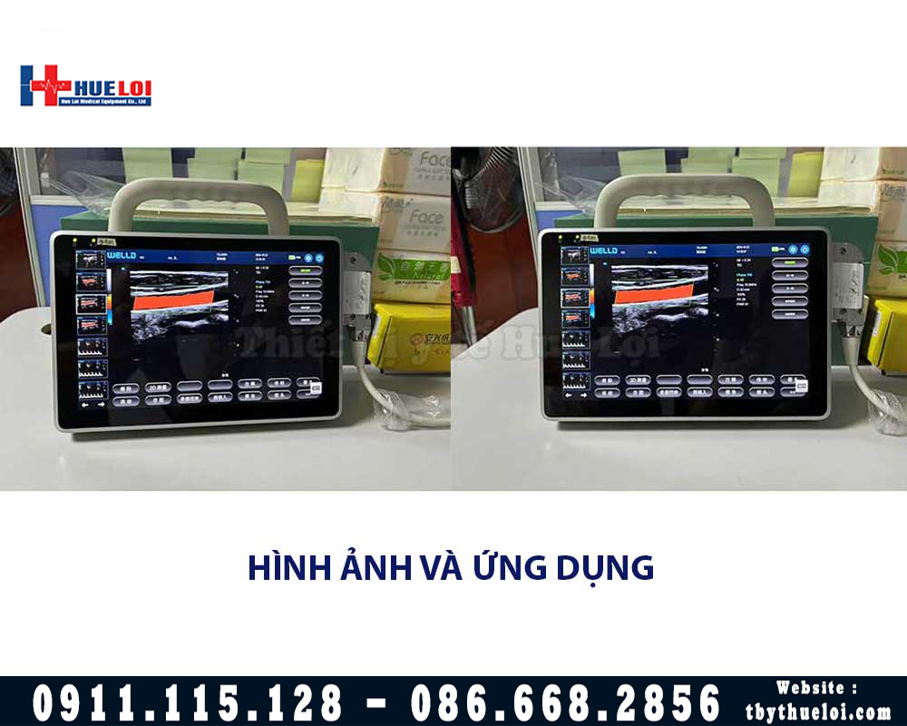 máy siêu âm sách tay doppler màu