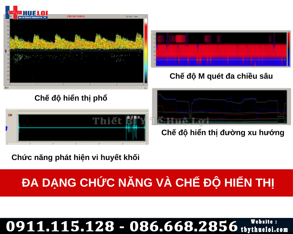 phần mềm máy đo lưu lượng máu não doppler xuyên sọ