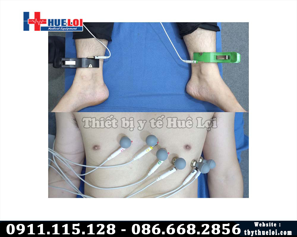 cách mắc điện cực máy điện tim 300G