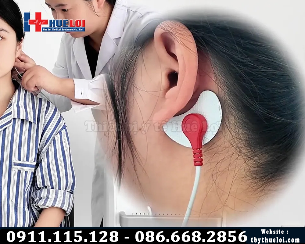 điều trị máy từ trường xuyên sọ