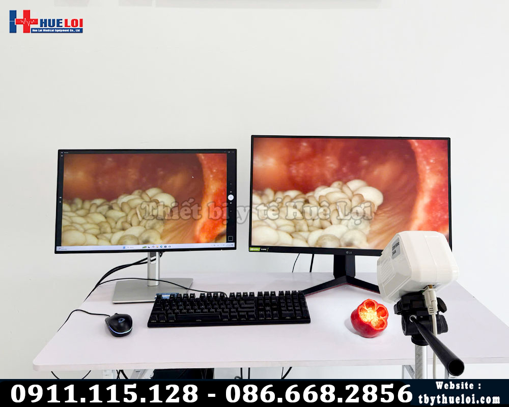 hình ảnh máy soi tử cung SD