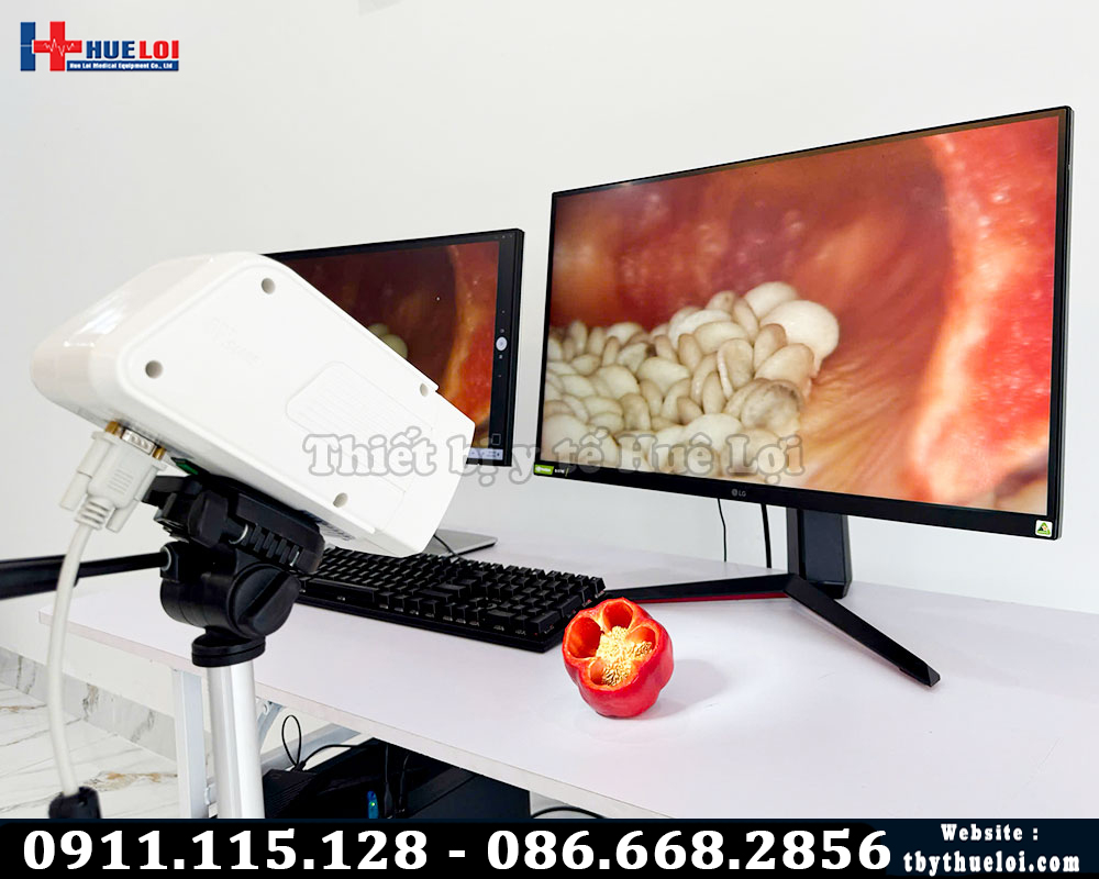 hình ảnh thực tế máy soi tử cung