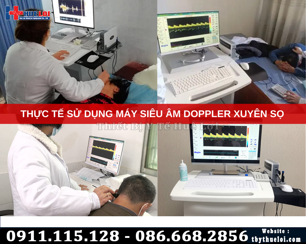 máy siêu âm doppler xuyên sọ 2 đầu