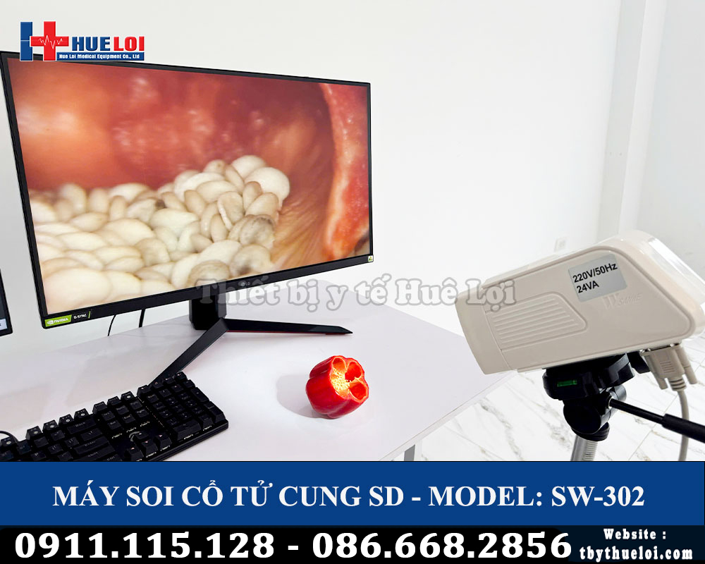 máy soi cổ tử cung SW302