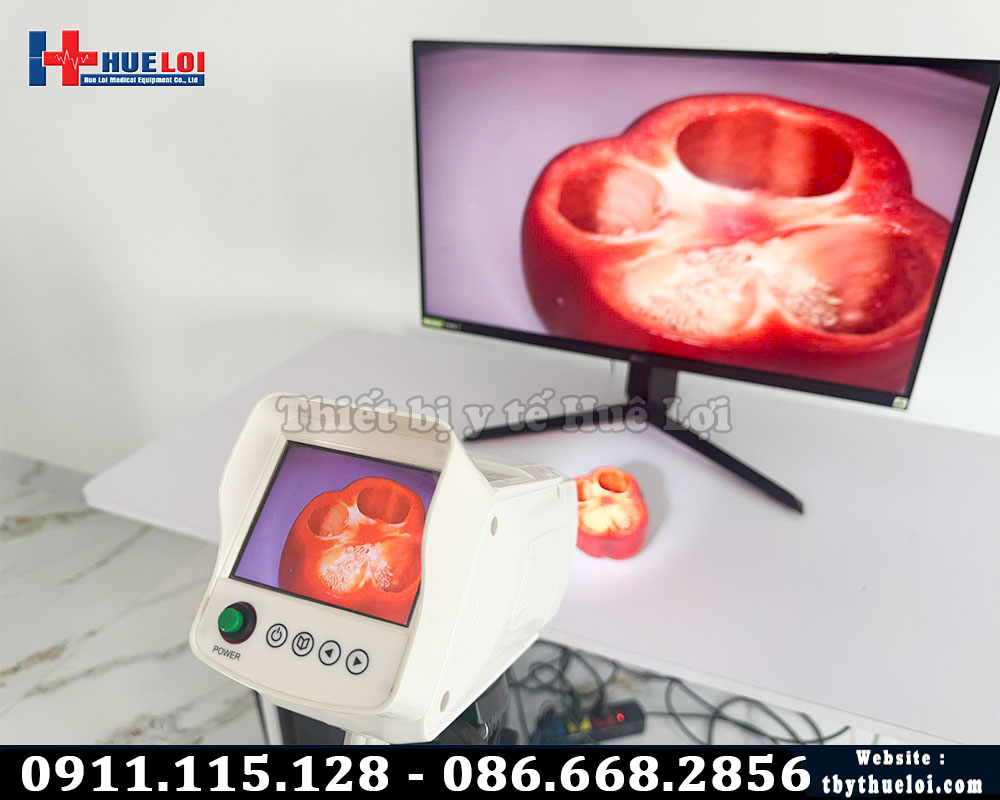 máy soi tử cung giá rẻ chất lượng HD
