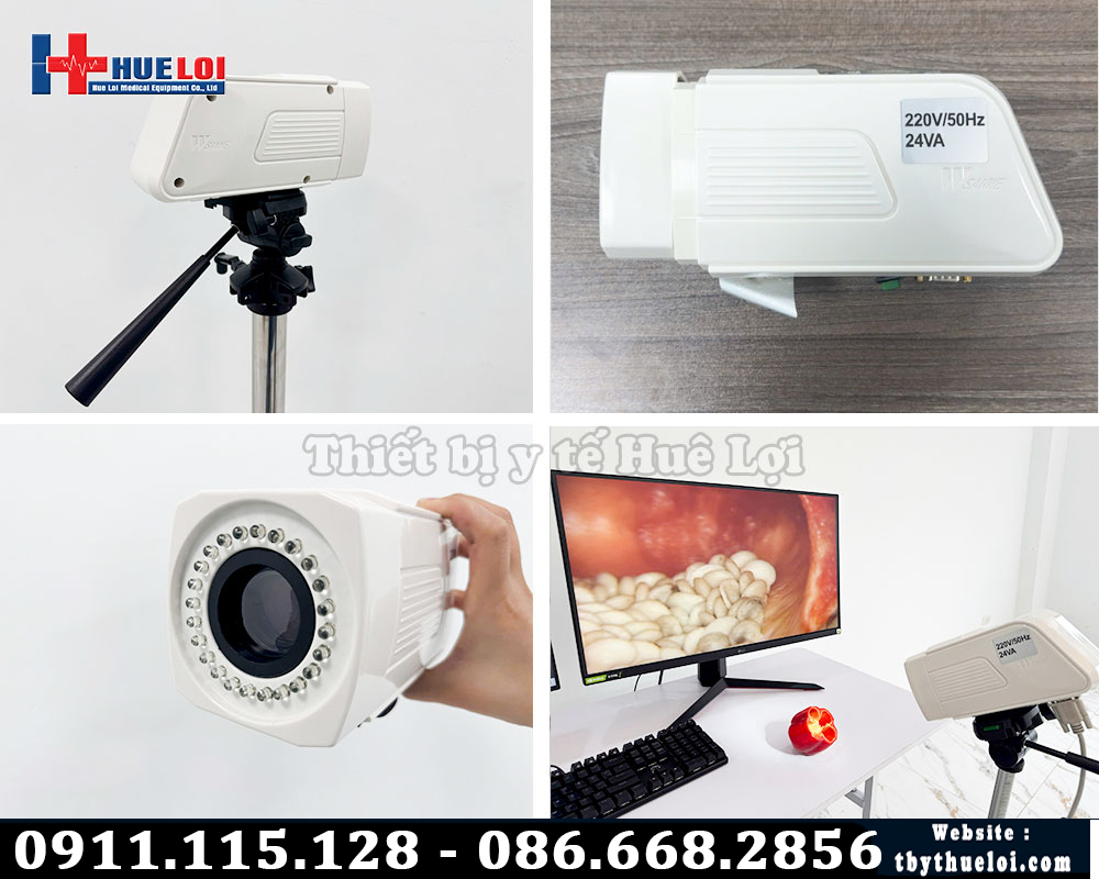 máy soi tử cung mới nhất