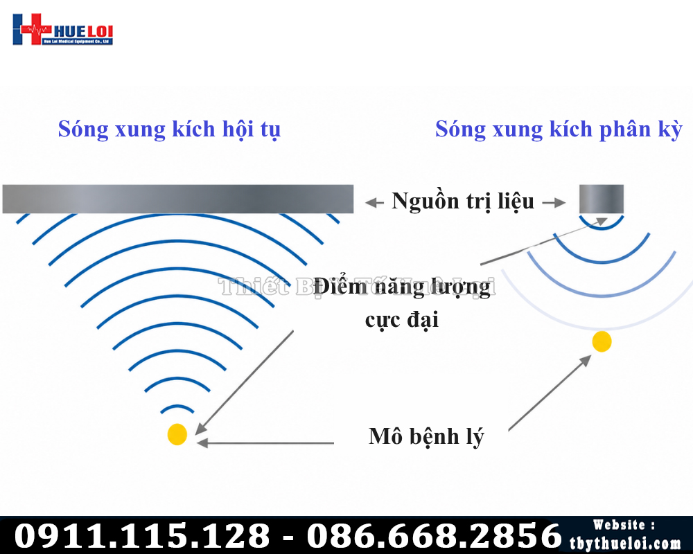 nguyên lý hoạt động máy xung kích hội tụ